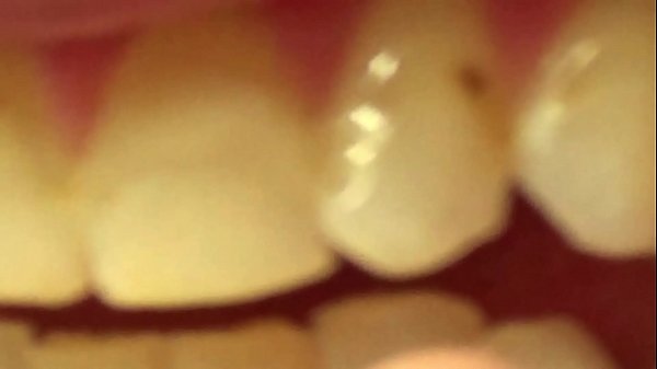 Brunette Shows Off Her Teeth and Fillings – Free HD Porn Video
