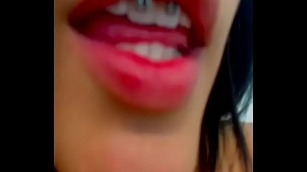 home d20 another beautiful braces girl – Free HD Porn Video